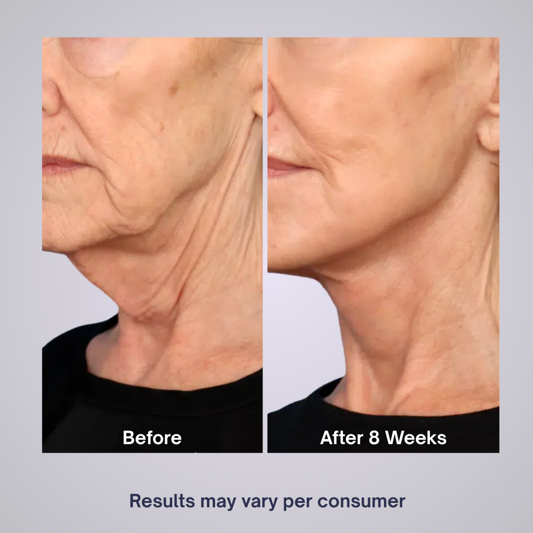 Tighten & Lift Neck Cream