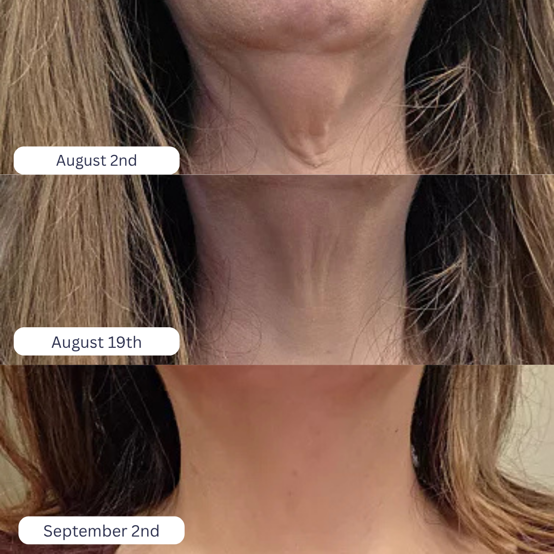 Tighten & Lift Neck Cream