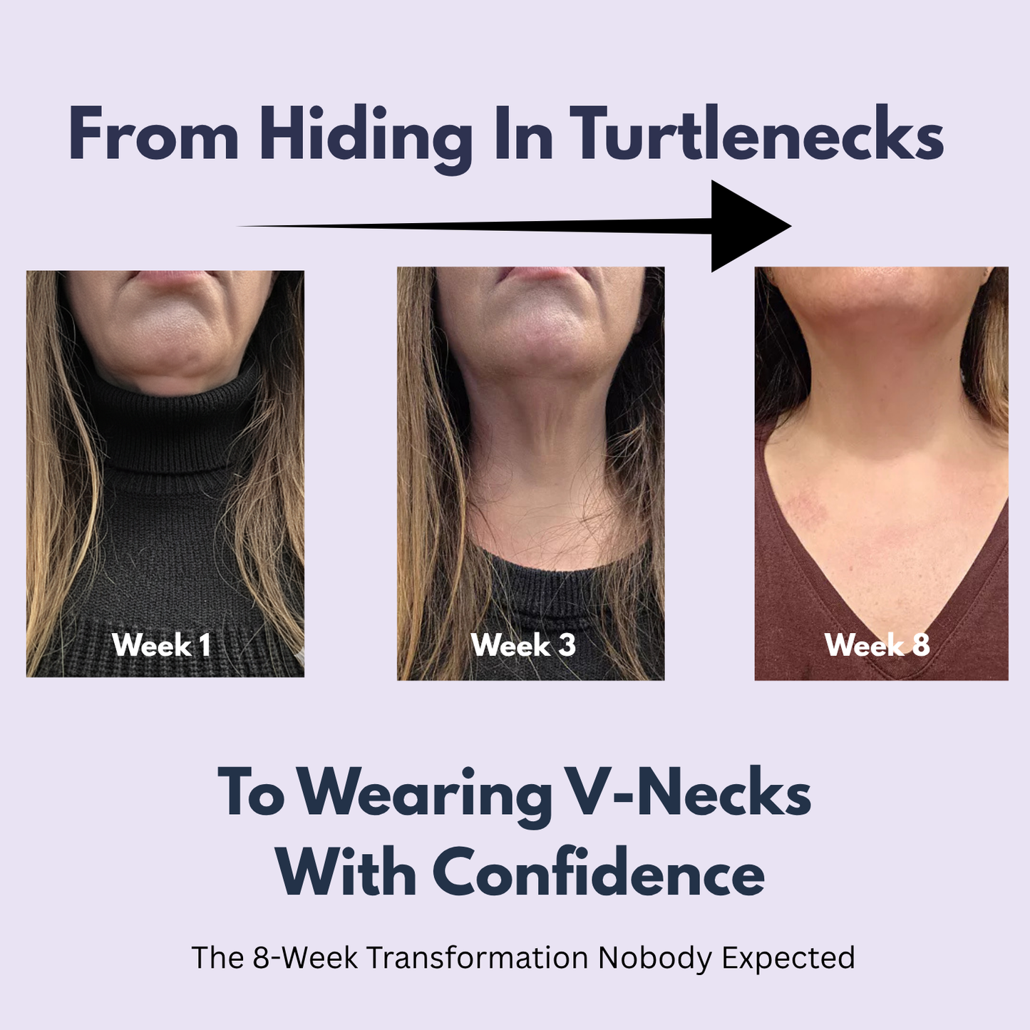 Tighten & Lift Neck Cream